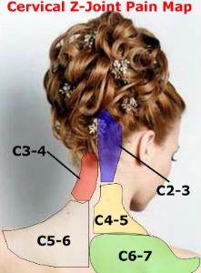 Pain in the cervical joints C2-C7